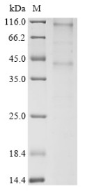 Chemerin-like receptor 1 (CMKLR1), human, recombinant