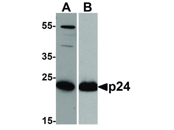Anti-HIV-1 p24, clone [7F4]
