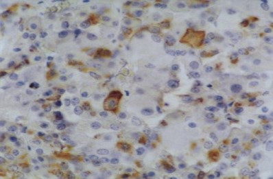 Anti-Prolactin, clone INN-hPRL-1