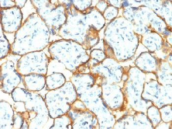 Anti-Insulin Receptor Alpha Recombinant Rabbit Monoclonal Antibody (clone:INSR/2277R)