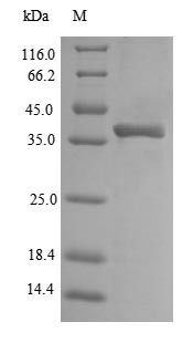 Outer membrane protein A (ompA), partial, Escherichia coli O157:H7, recombinant