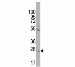 Anti-CD8B