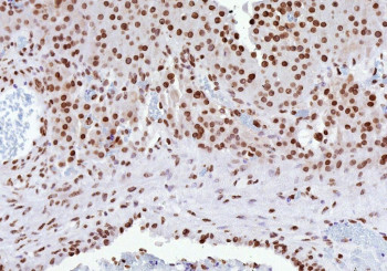 Anti-ESR2 / Estrogen Receptor beta, clone ESR2/9709