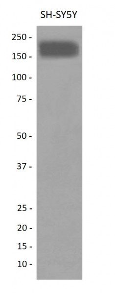 Anti-CD56 / NCAM