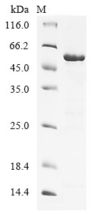 Serine/threonine-protein kinase 38-like (STK38L), partial, human, recombinant