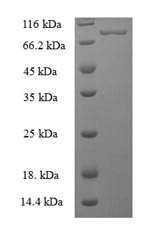 Bifunctional polynucleotide phosphatase/kinase (PNKP), human, recombinant