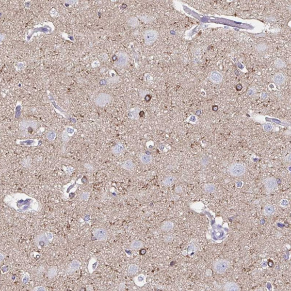 Anti-UGT3A1