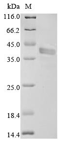 Fructose-bisphosphate aldolase A (Aldoa), mouse, recombinant