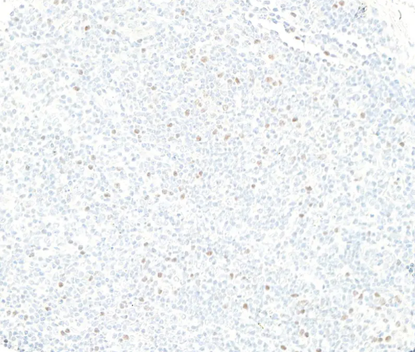 Anti-FOXP3 Recombinant Monoclonal