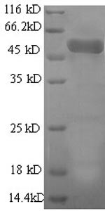 Actin-related protein 2/3 complex subunit 2 (ARPC2), partial, human, recombinant