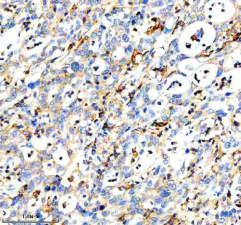 Anti-DOCK8 / Dedicator of cytokinesis protein 8