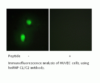 Anti-hnRNP C1/C2