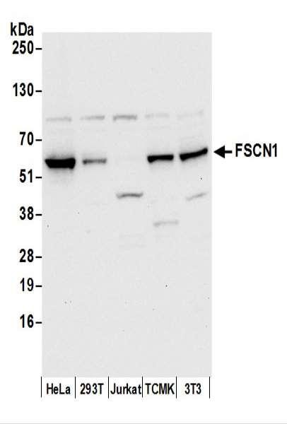 Anti-FSCN1