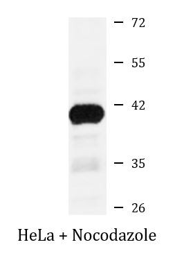 Anti-phospho-NPM1 (Thr199)
