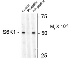 Anti-phospho-S6 Kinase 1 (Thr449)