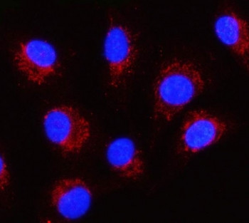 Anti-Serpin B8 / SERPINB8