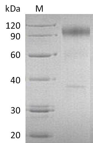 Interleukin-23 receptor (IL23R), partial (Active), human, recombinant