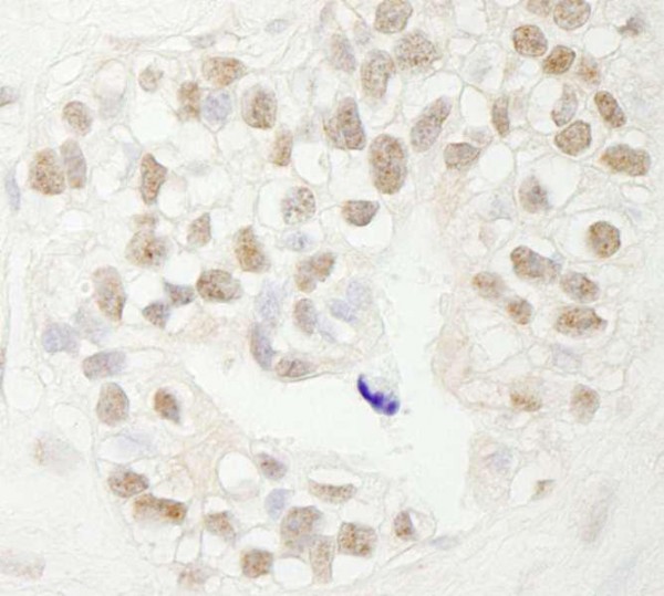 Anti-FBW7 (IHC)