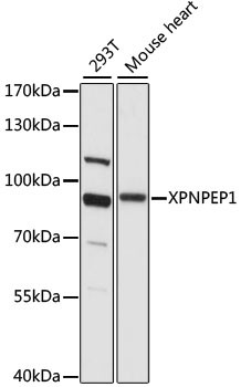 Anti-XPNPEP1