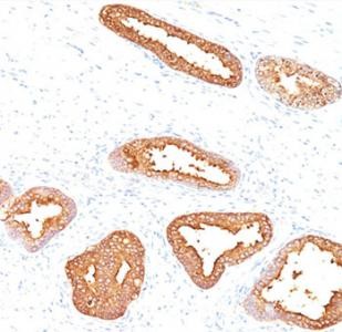 Anti-Prostate Specific Antigen PSA, clone A67-B/E3