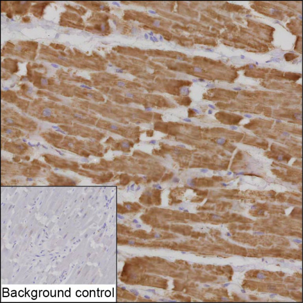 Anti-ATP5PD