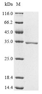 B-cell CLL/lymphoma 9 protein (BCL9), partial, human, recombinant