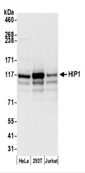 Anti-HIP1/Huntingtin-interacting Protein 1