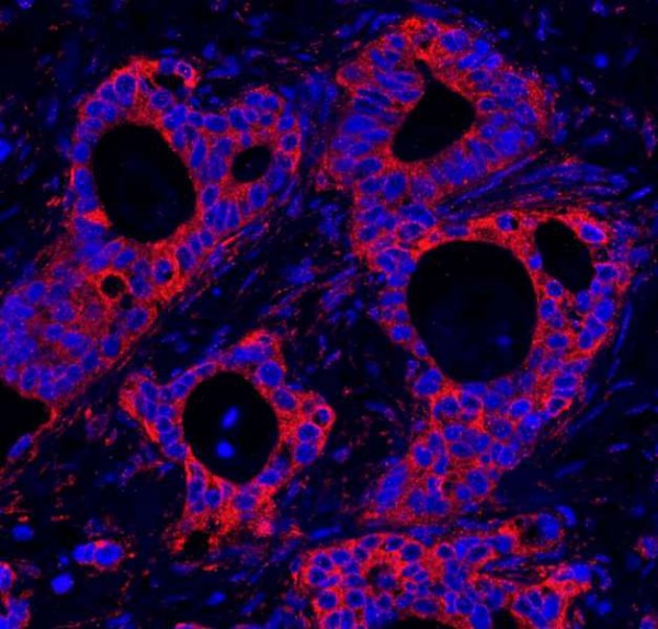 Anti-HPIP (IHC)