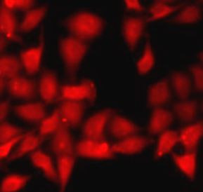 Anti-Mannose Phosphate Isomerase