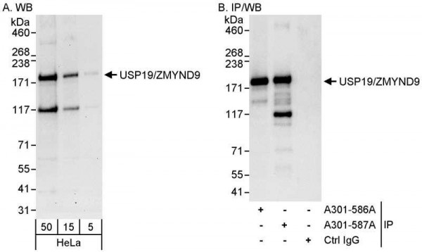 Anti-USP19/ZMYND9