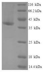 Death domain-containing protein CRADD (CRADD), human, recombinant