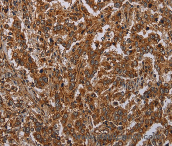 Anti-ATP2A1