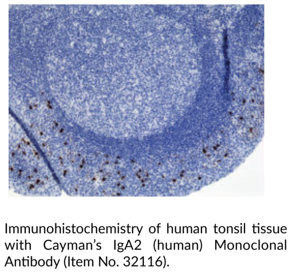 Anti-IgA2 (human) Monoclonal Antibody (Clone RM125)