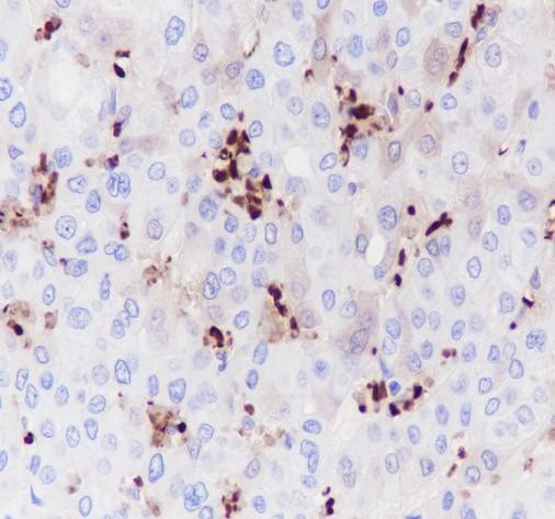 Anti-Recombinant Hemoglobin Alpha, clone A244