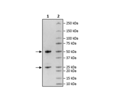 Anti-CD30 Antibody (Brentuximab)