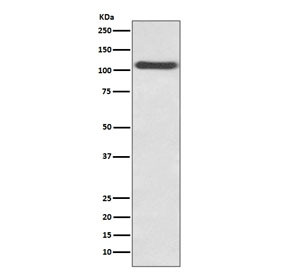Anti-P-Selectin / SELP / CD62P, clone AAEC-19