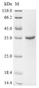 Egl nine homolog 2 (EGLN2), Partial, human, recombinant