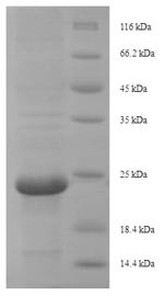 Beta-mammal toxin Css4, Centruroides suffusus, recombinant