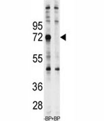 Anti-Ubiquilin1