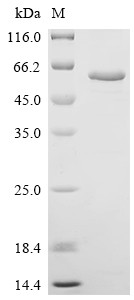 Copper-transporting ATPase 2 (ATP7B), partial, human, recombinant