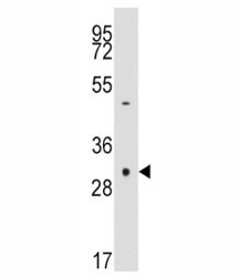 Anti-Caspase-3