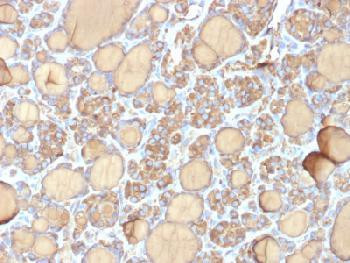 Anti-Thyroglobulin (Thyroidal Cell Marker) Recombinant Mouse Monoclonal Antibody (clone:r6E1)