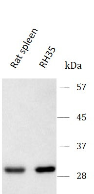 Anti-PSME1