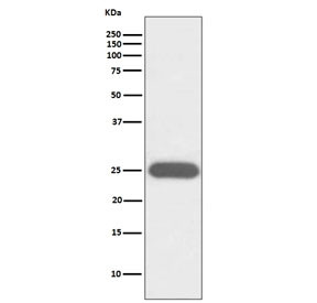 Anti-CSF3 / Granulocyte-Colony Stimulating Factor, clone ABAC-3