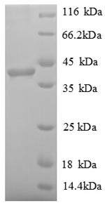 Poly [ADP-ribose] polymerase 1 (PARP11), partial, human, recombinant