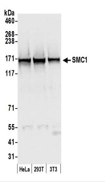 Anti-SMC1