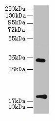Anti-TMEM91