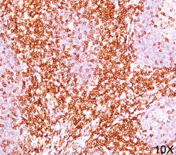 Anti-CD6 Cocktail, clone C6/372 + 3F7B5