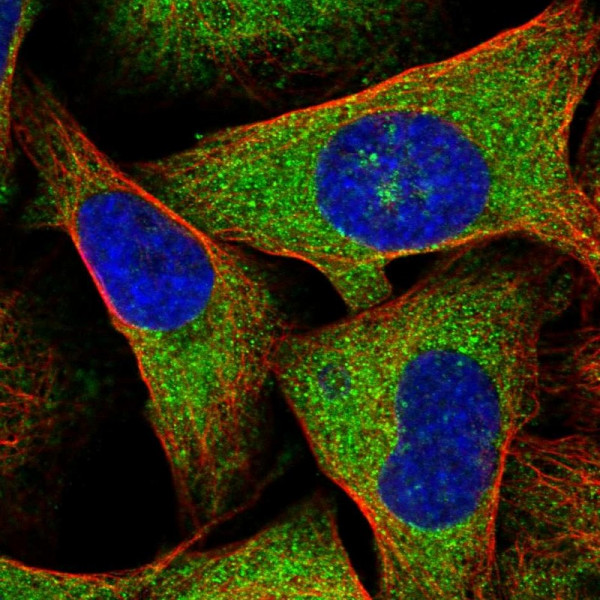Anti-FSTL1