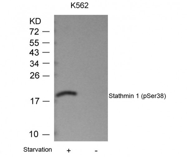 Anti-phospho-Stathmin 1 (Ser38)